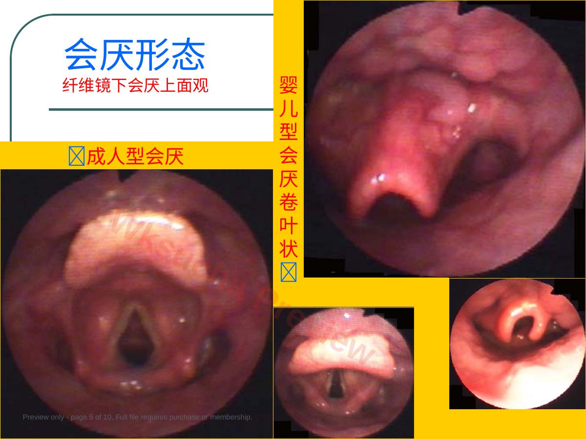 预览第 5 页