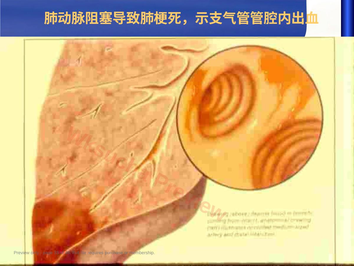预览第 33 页
