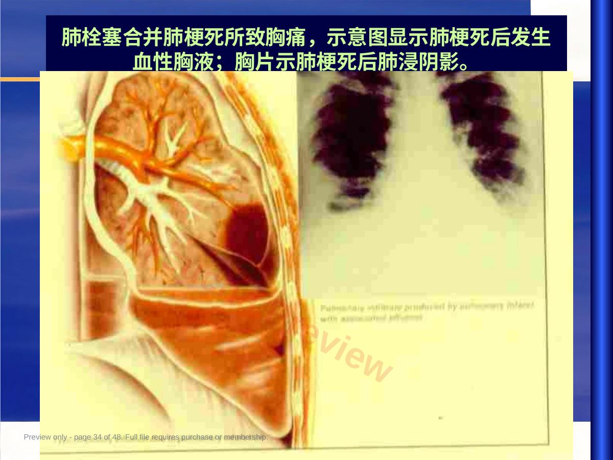 预览第 34 页