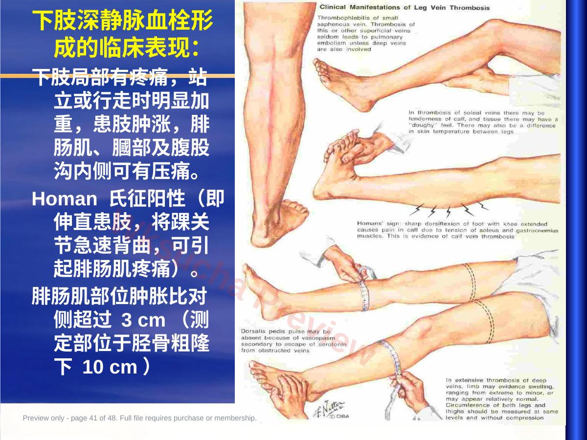 预览第 41 页