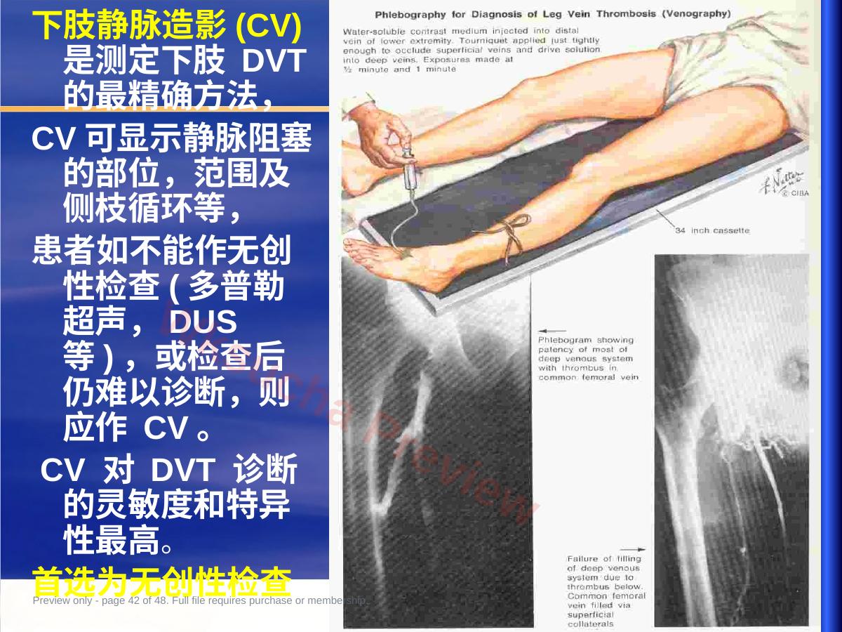 预览第 42 页