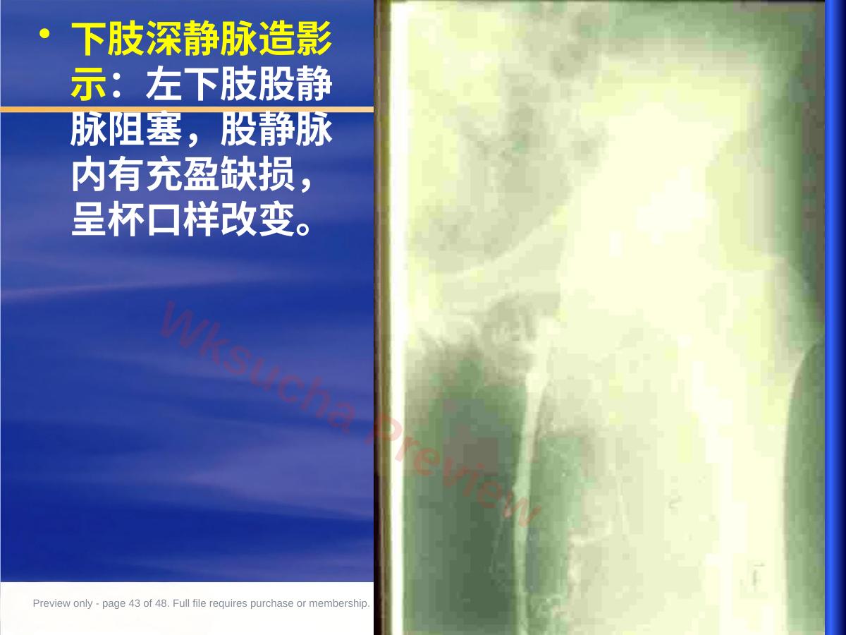 预览第 43 页