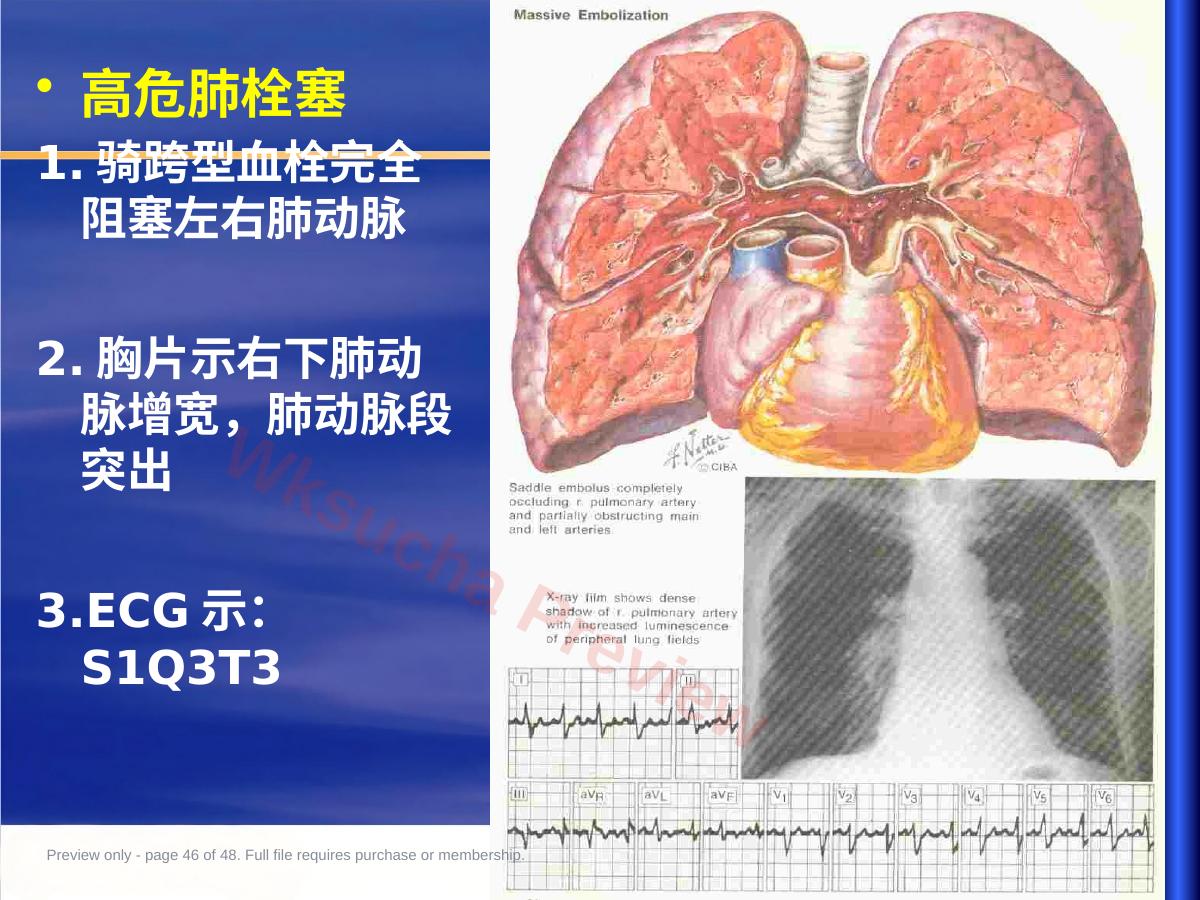 预览第 46 页