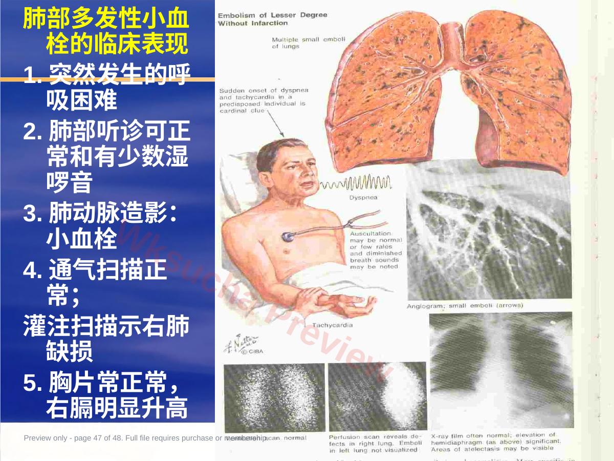 预览第 47 页