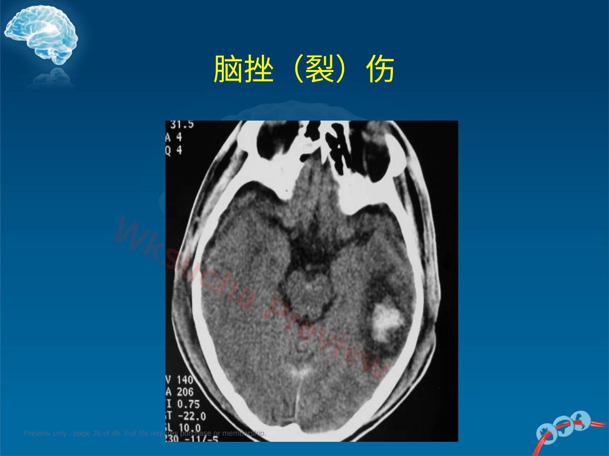 预览第 26 页