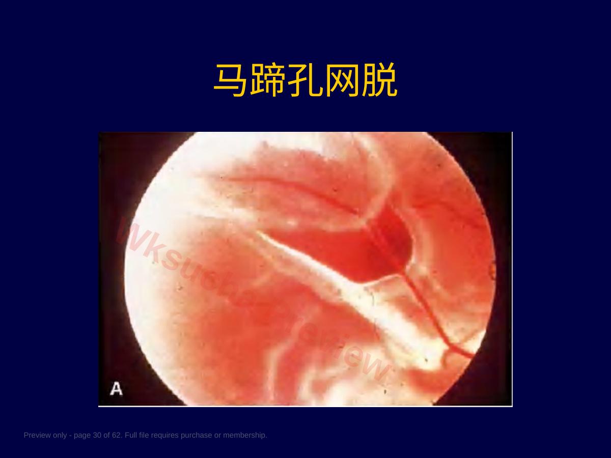 预览第 30 页