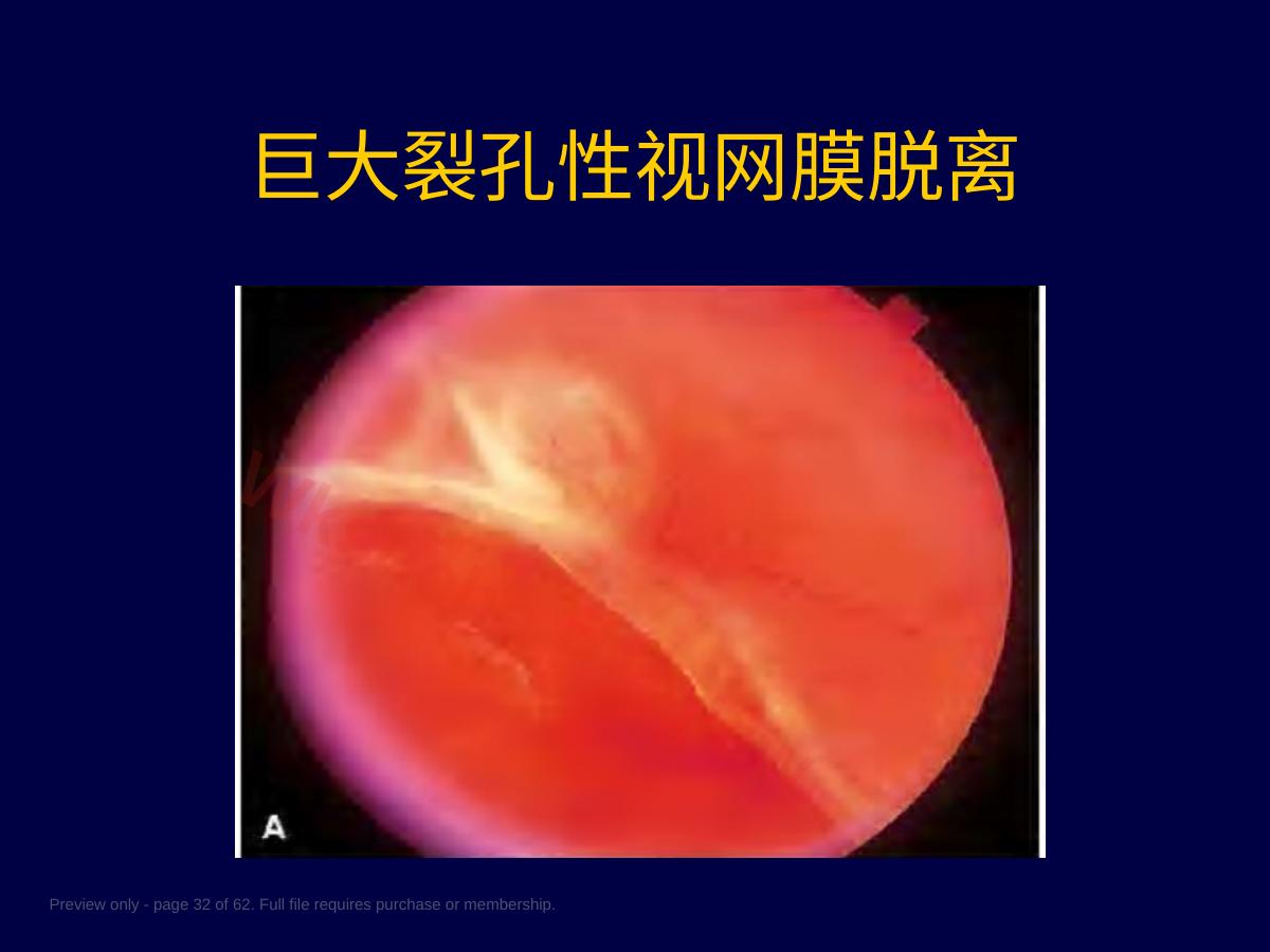 预览第 32 页