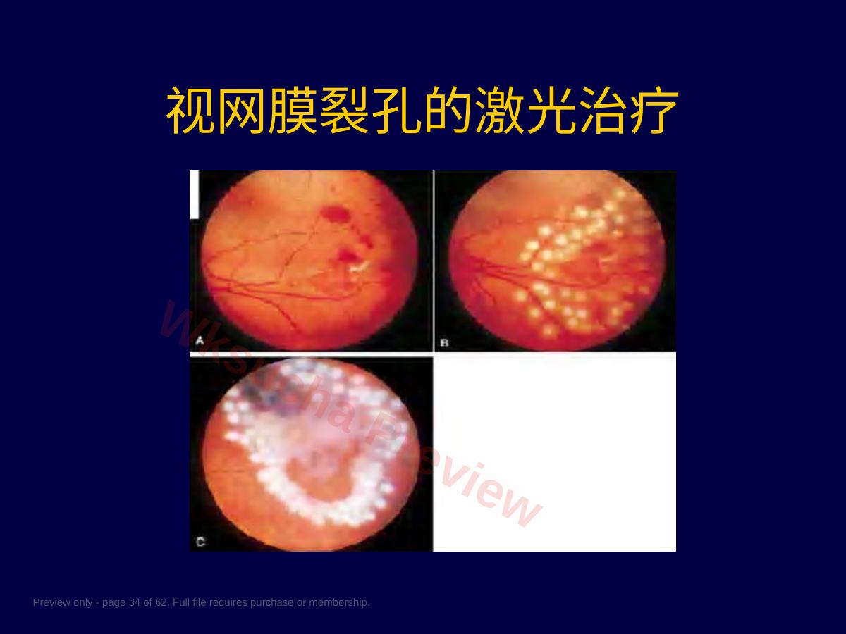 预览第 34 页