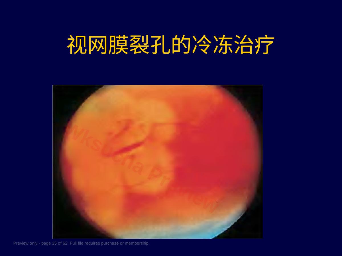 预览第 35 页
