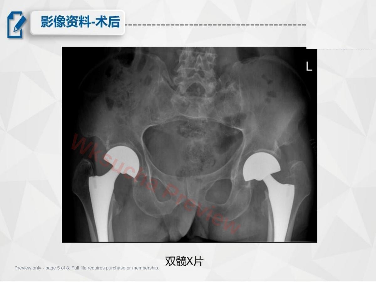预览第 5 页