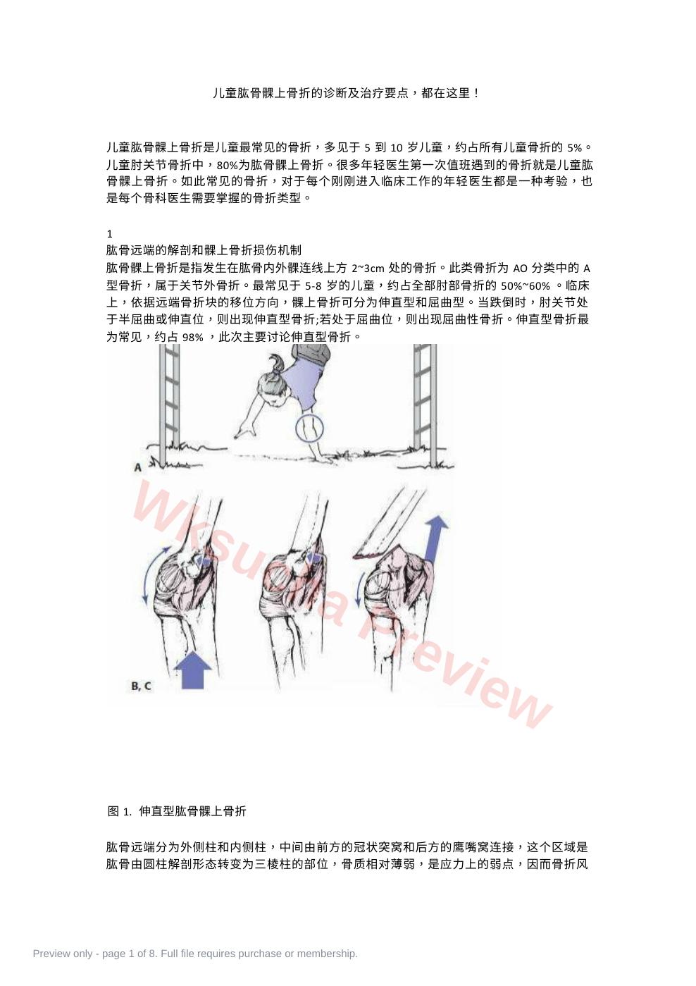 儿童肱骨髁上骨折的诊断及治疗要点
