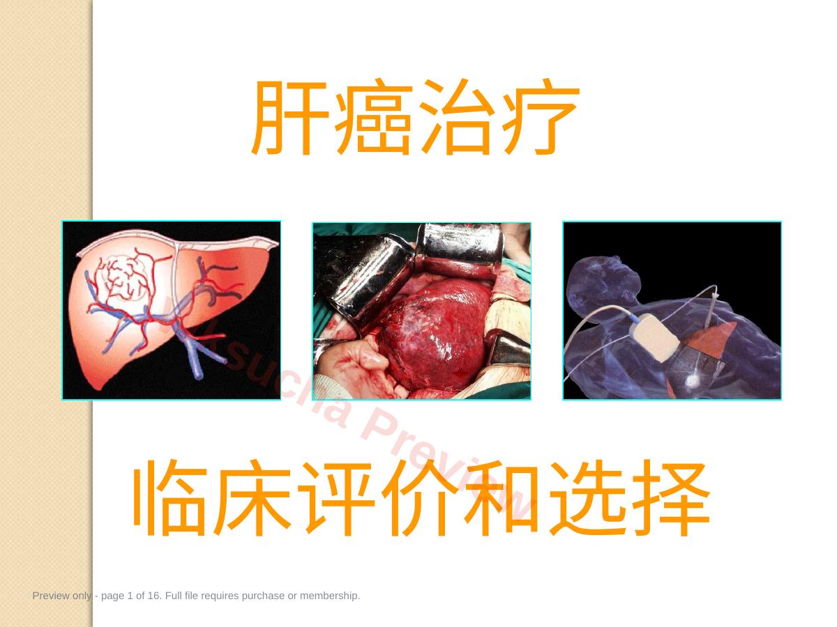 肝癌治疗临床评价和选择PPT课件