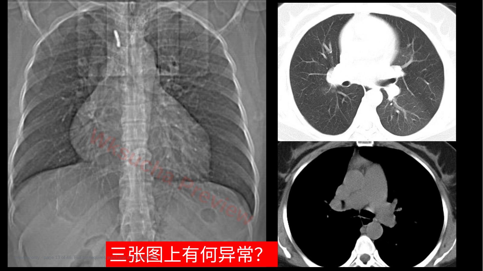 预览第 13 页