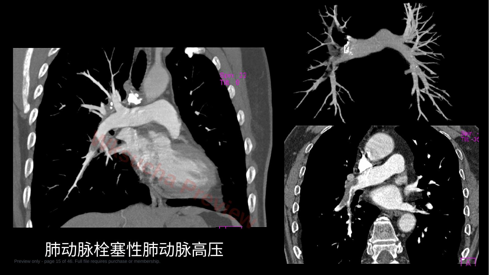 预览第 15 页