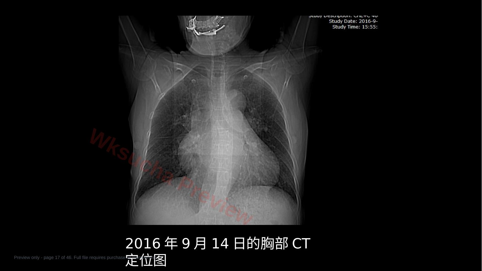 预览第 17 页