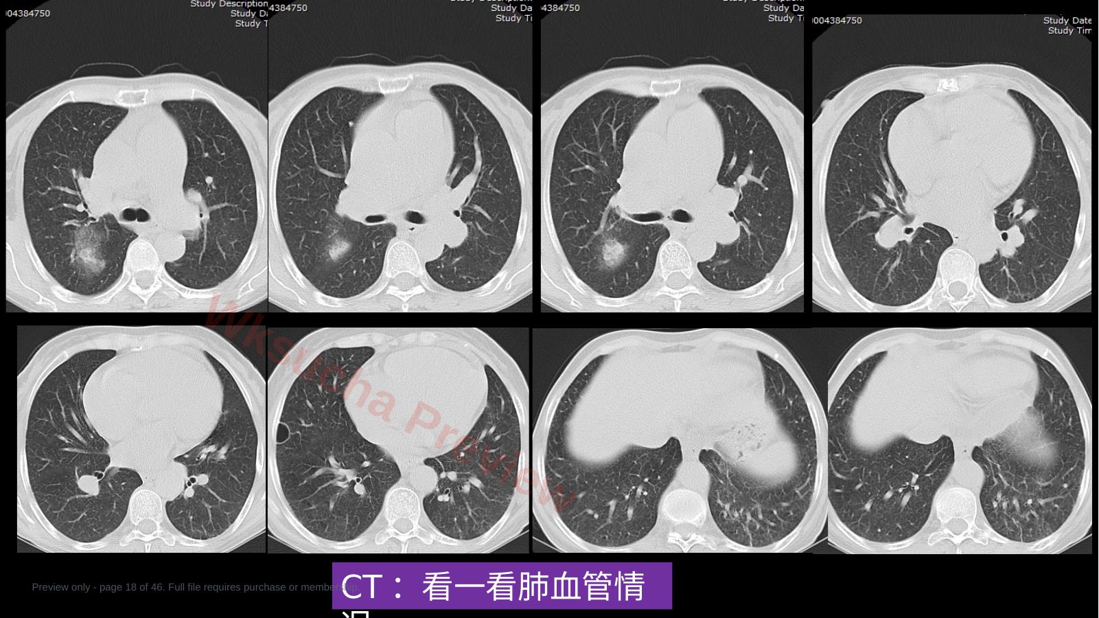 预览第 18 页