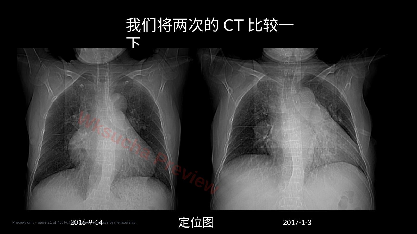 预览第 21 页