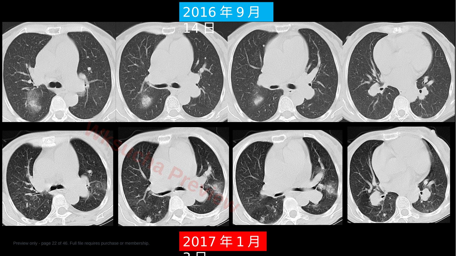 预览第 22 页
