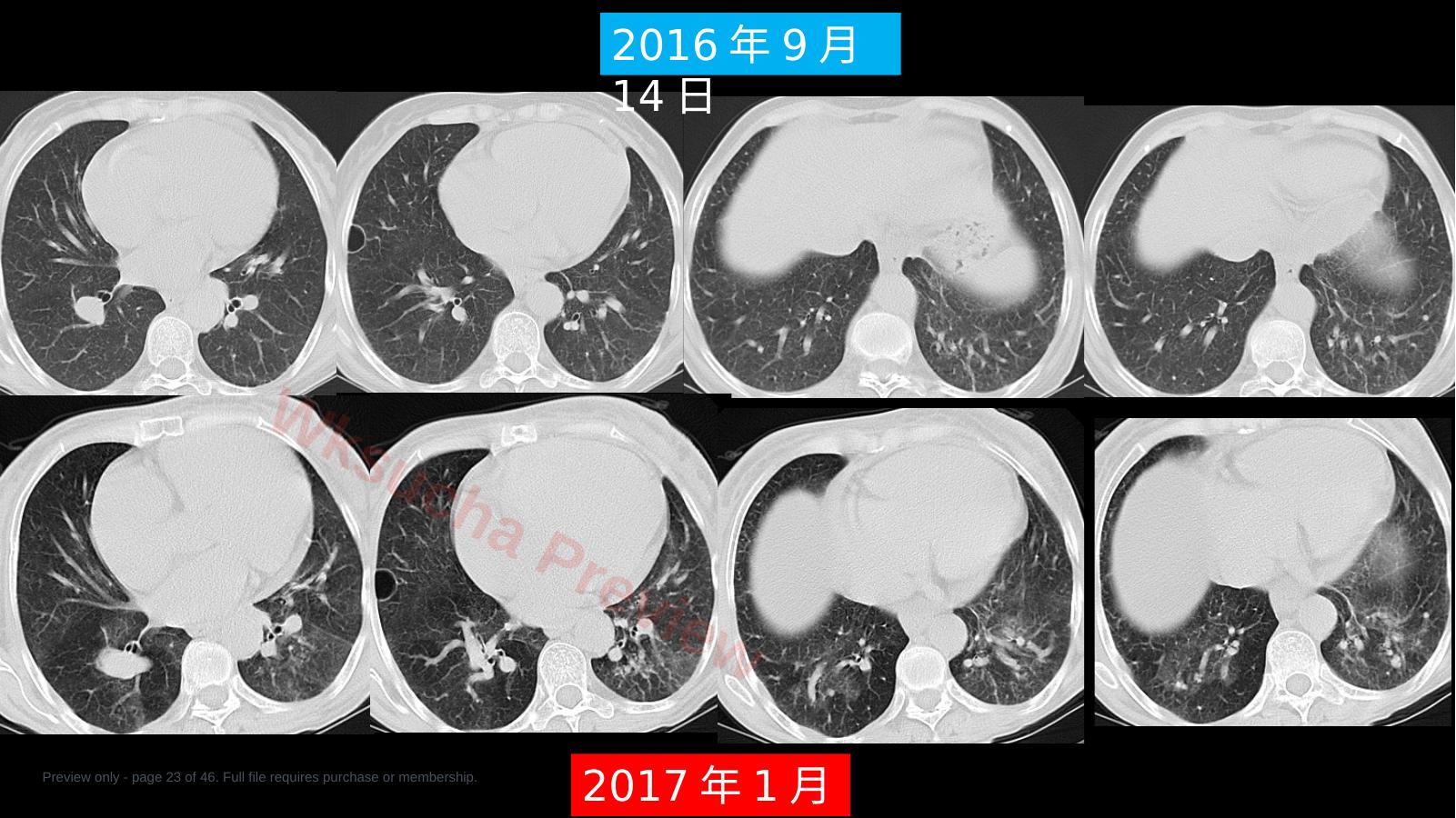 预览第 23 页