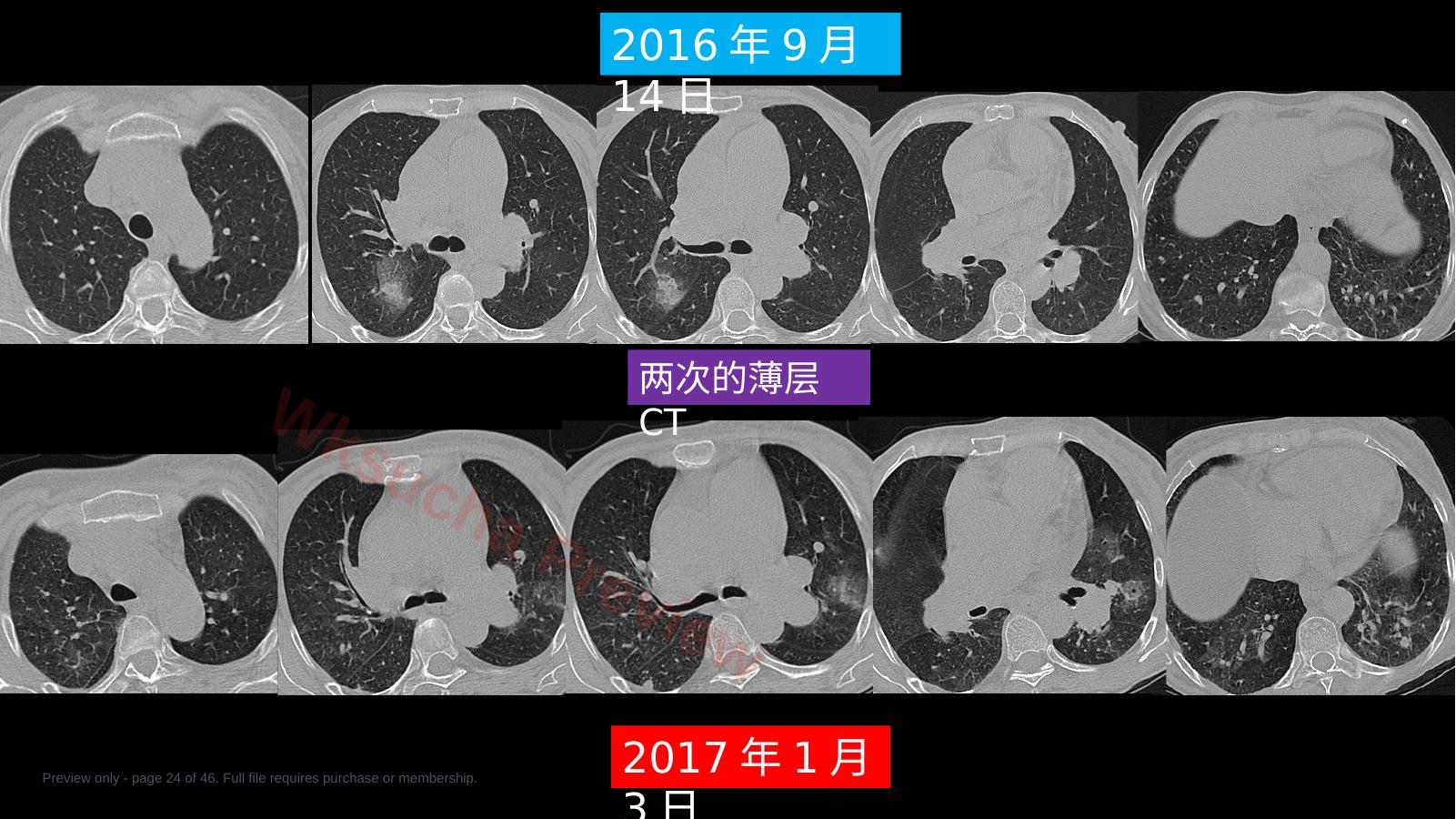 预览第 24 页
