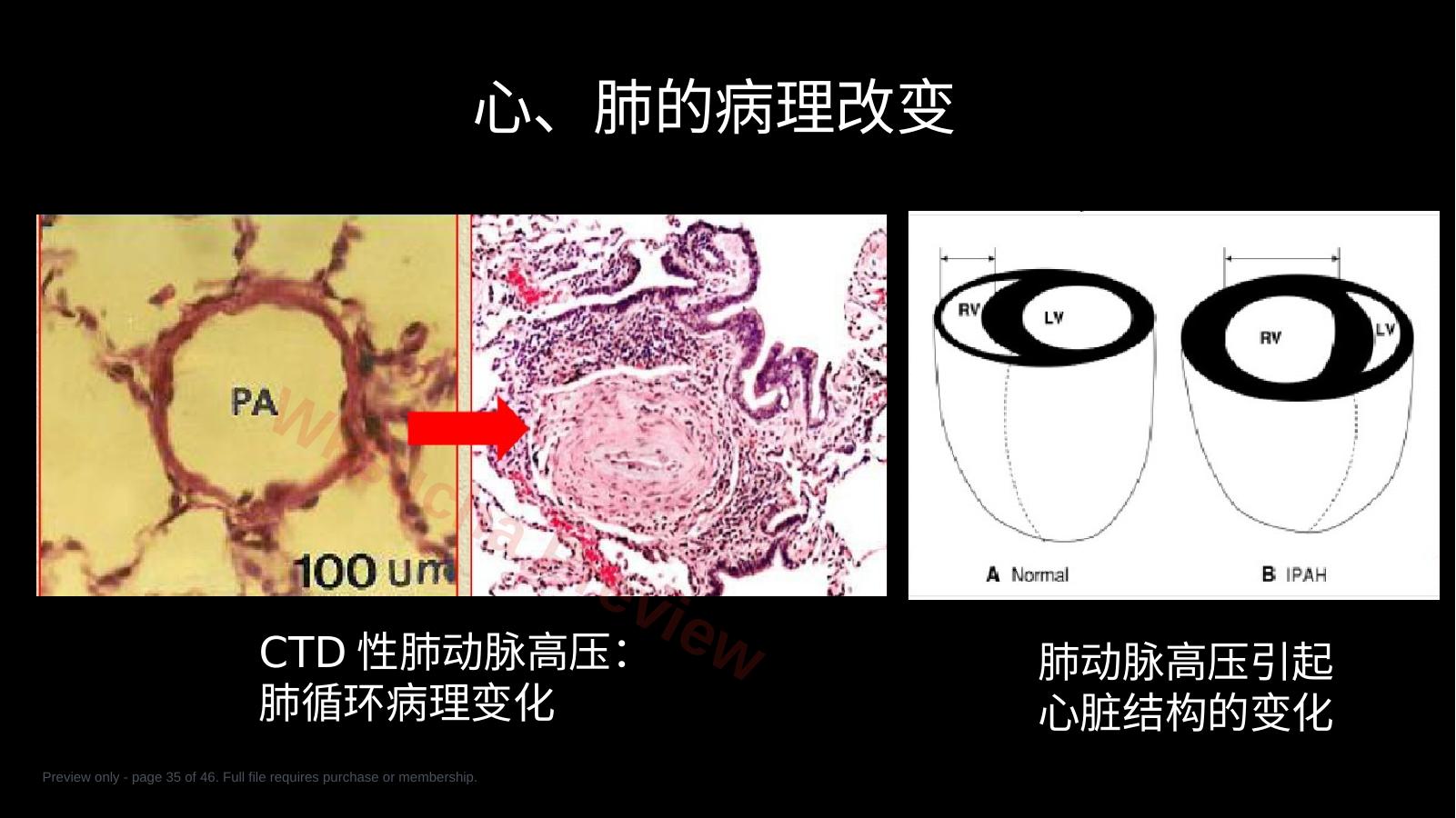预览第 35 页