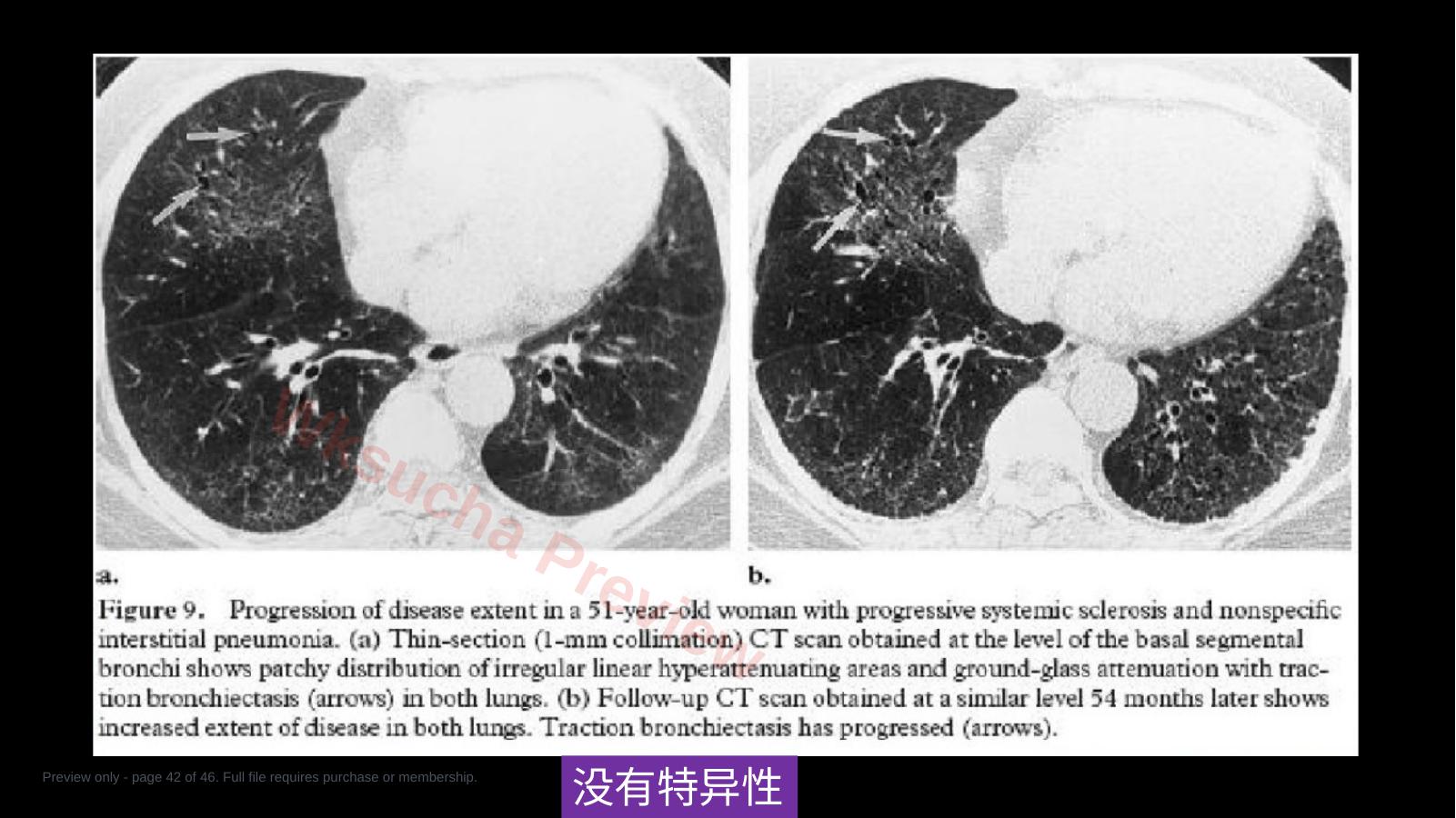 预览第 42 页