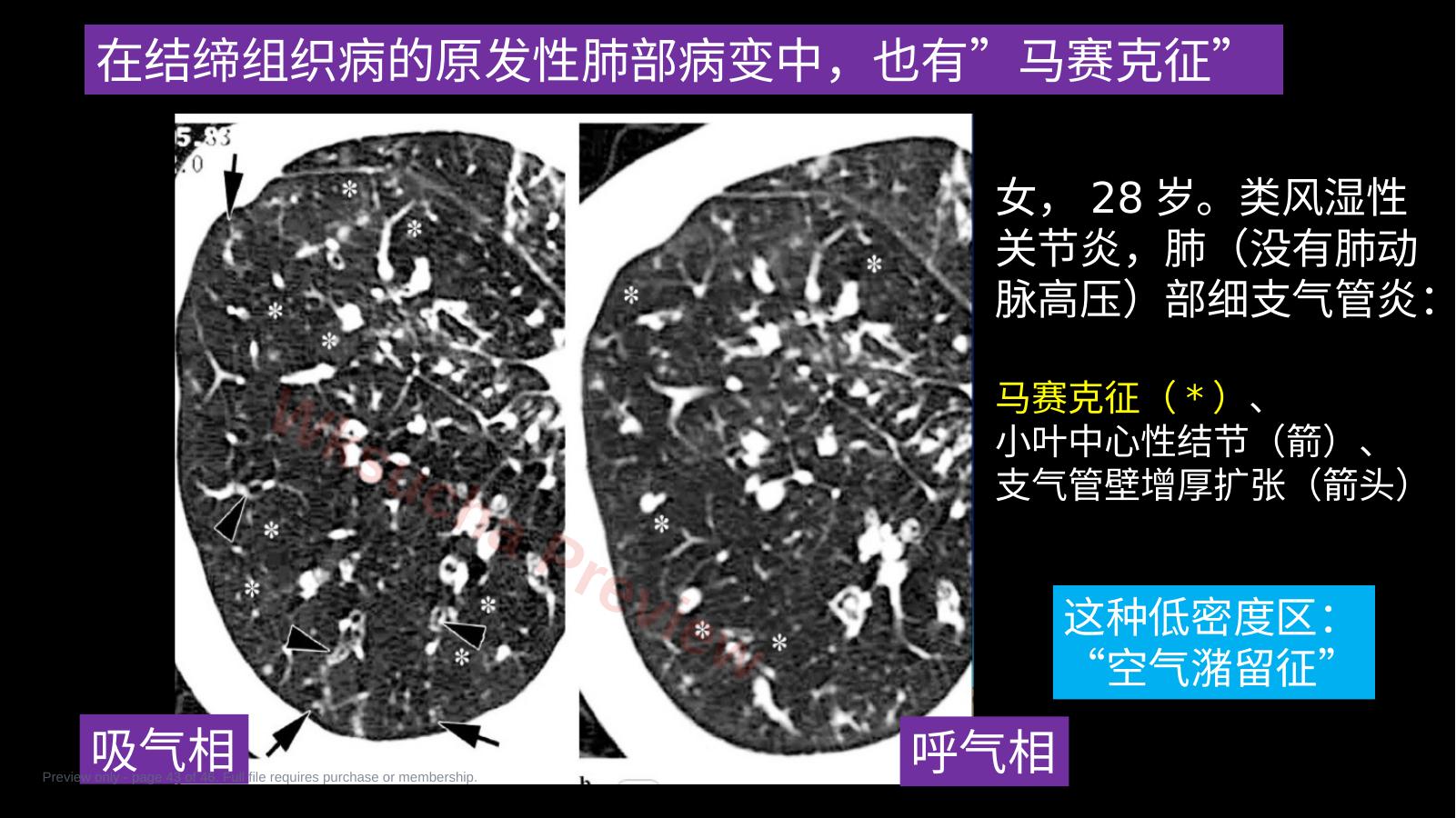 预览第 43 页