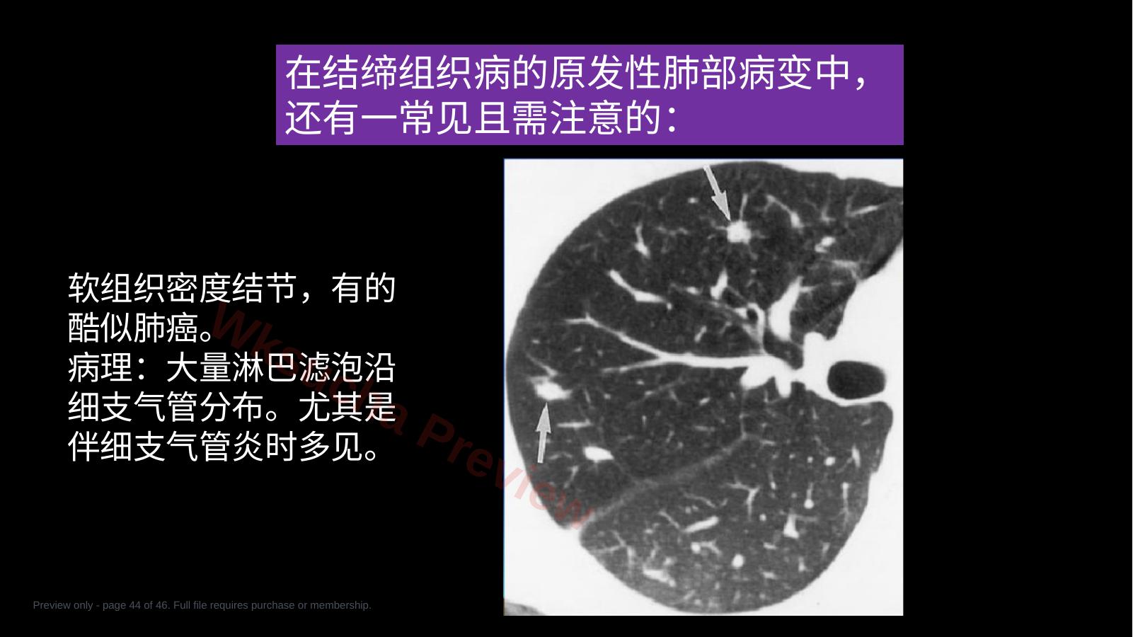 预览第 44 页