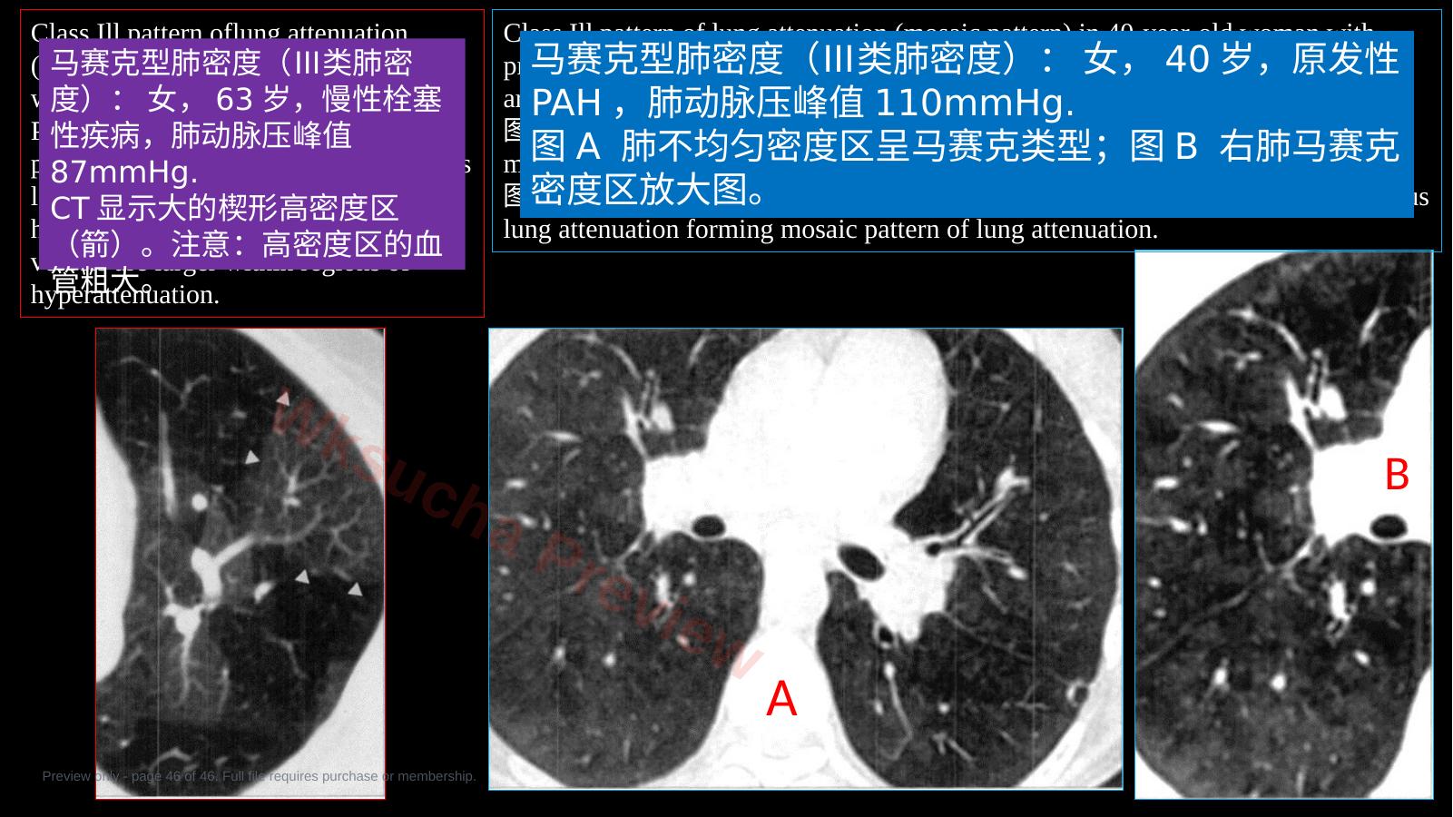 预览第 46 页