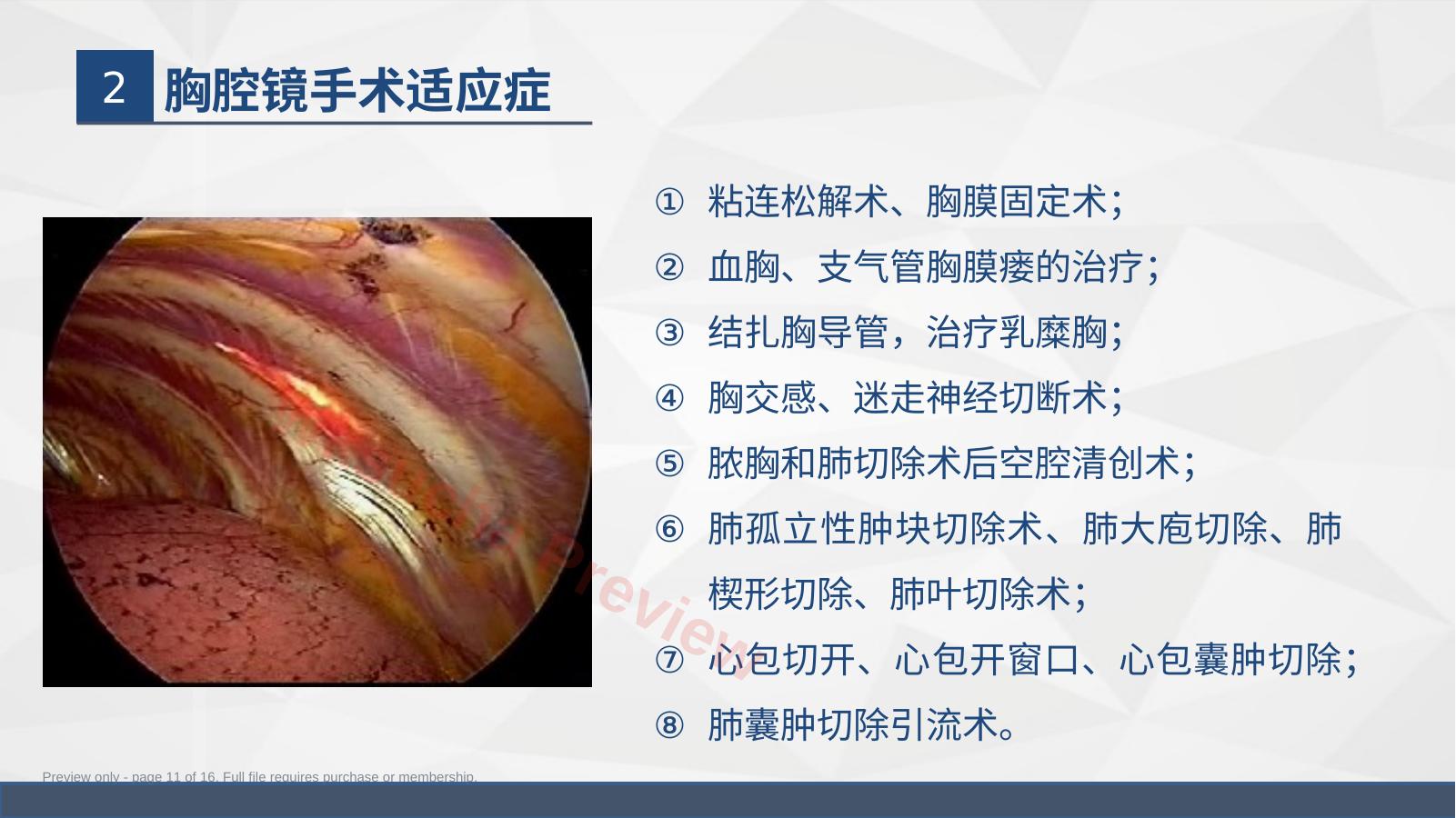 预览第 11 页