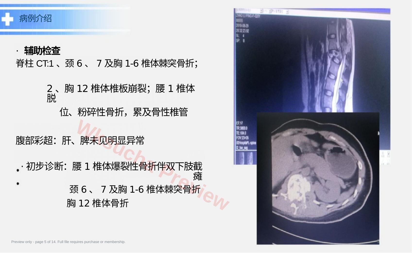 预览第 5 页