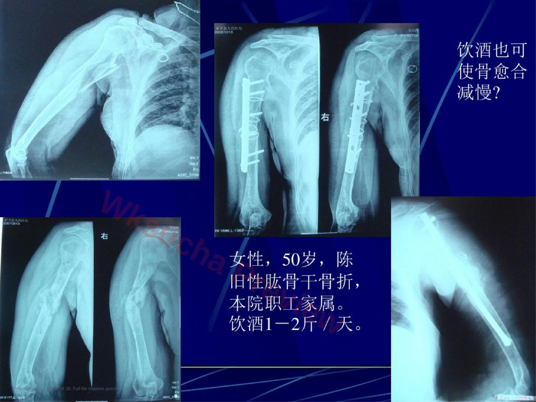 预览第 10 页