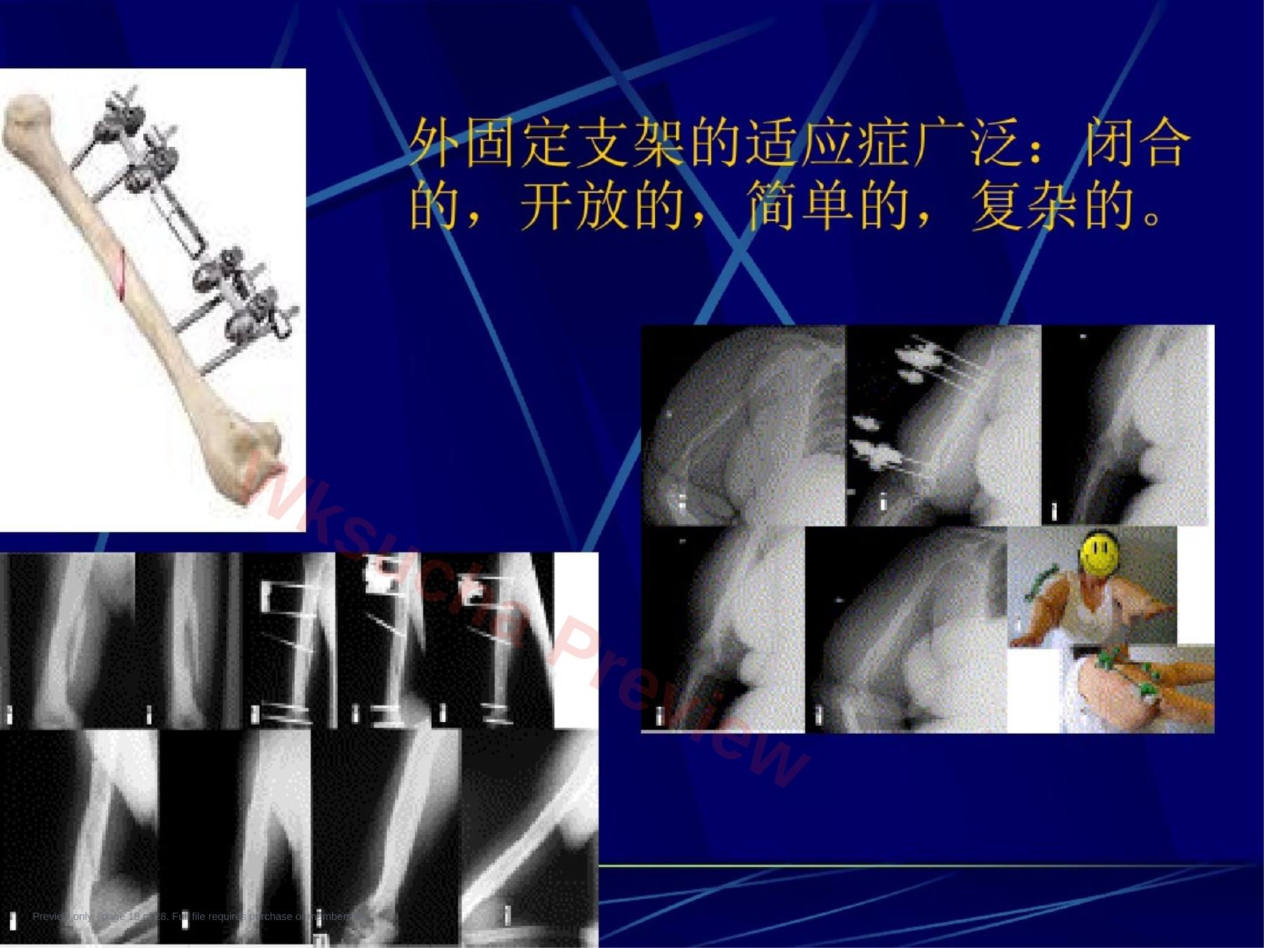 预览第 18 页