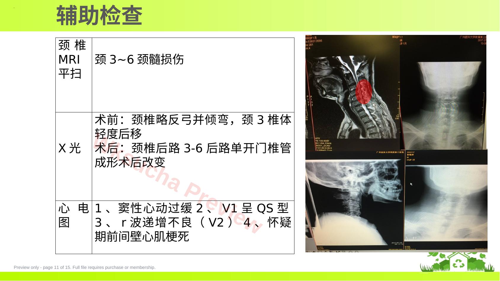 预览第 11 页