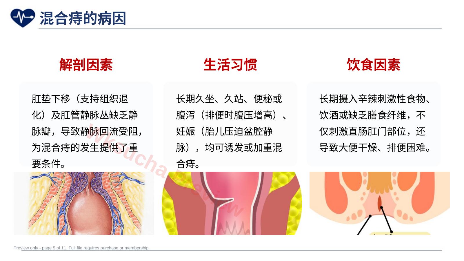 预览第 5 页