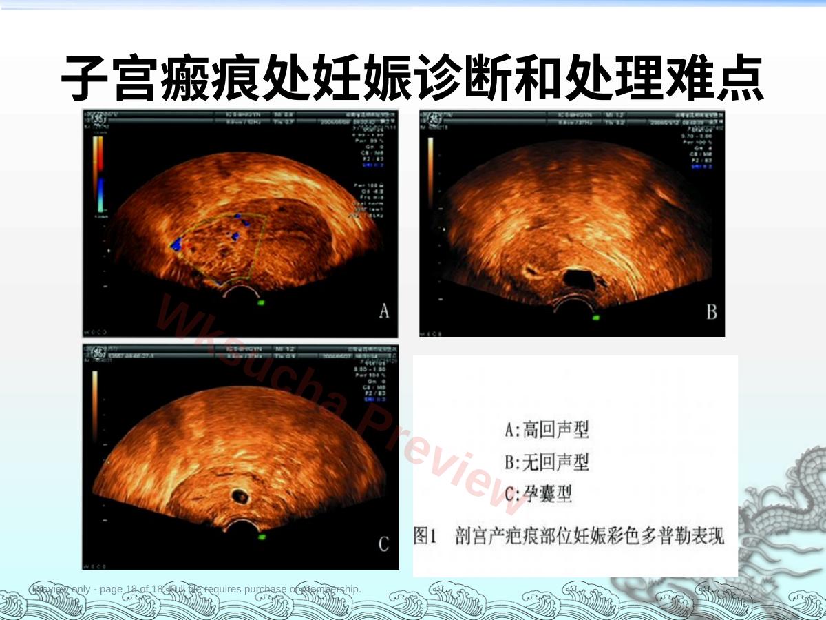 预览第 18 页