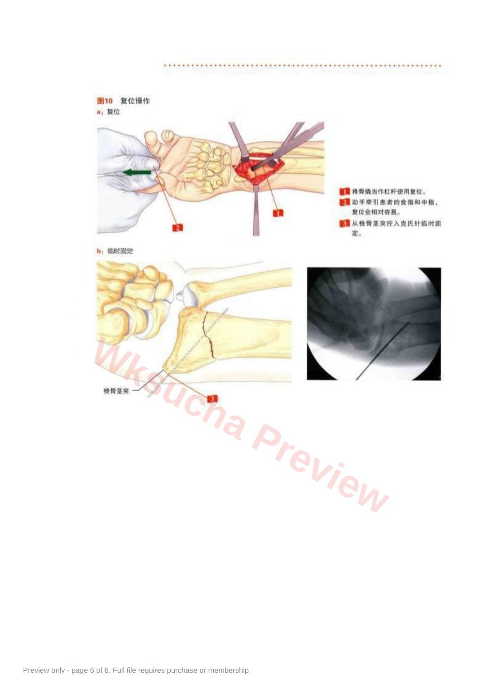 预览第 6 页
