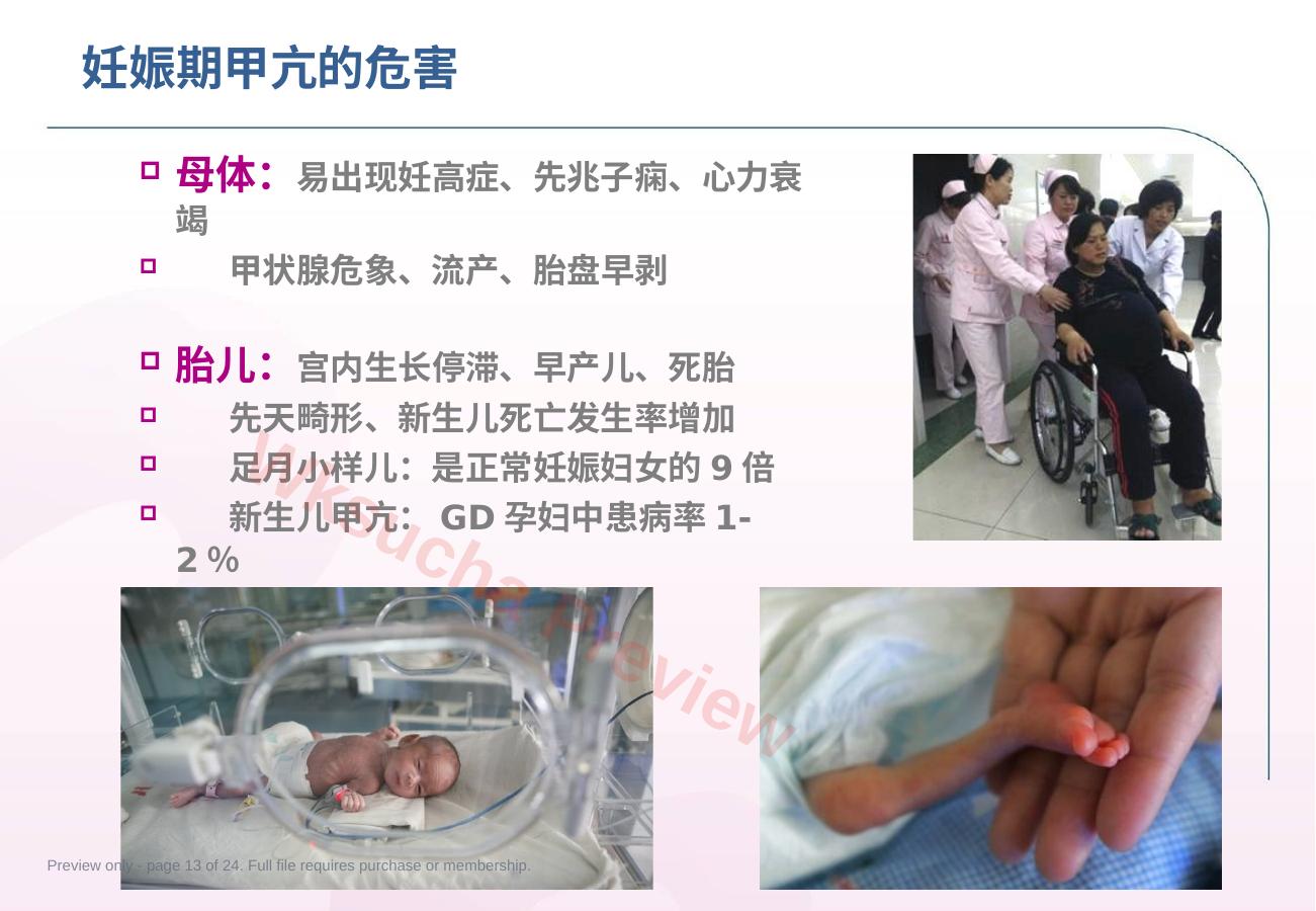 预览第 13 页