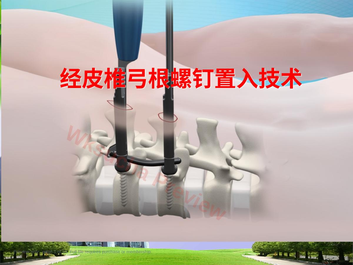 经皮椎弓根 钉置入技术