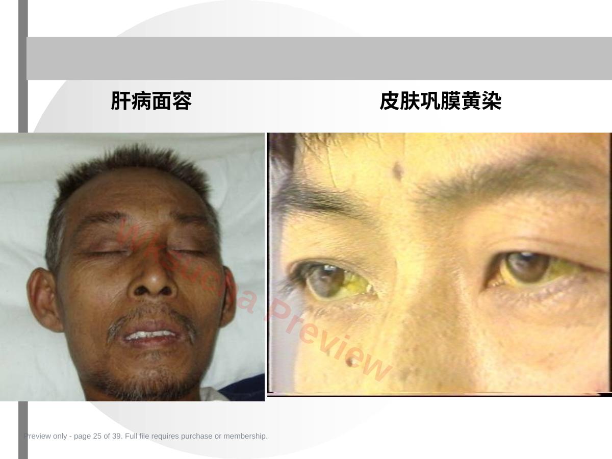预览第 25 页
