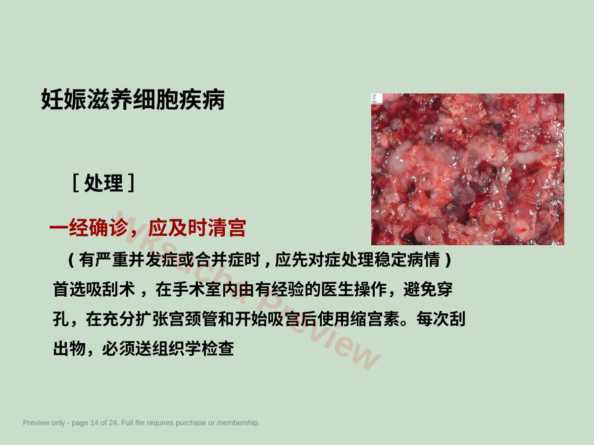 预览第 14 页