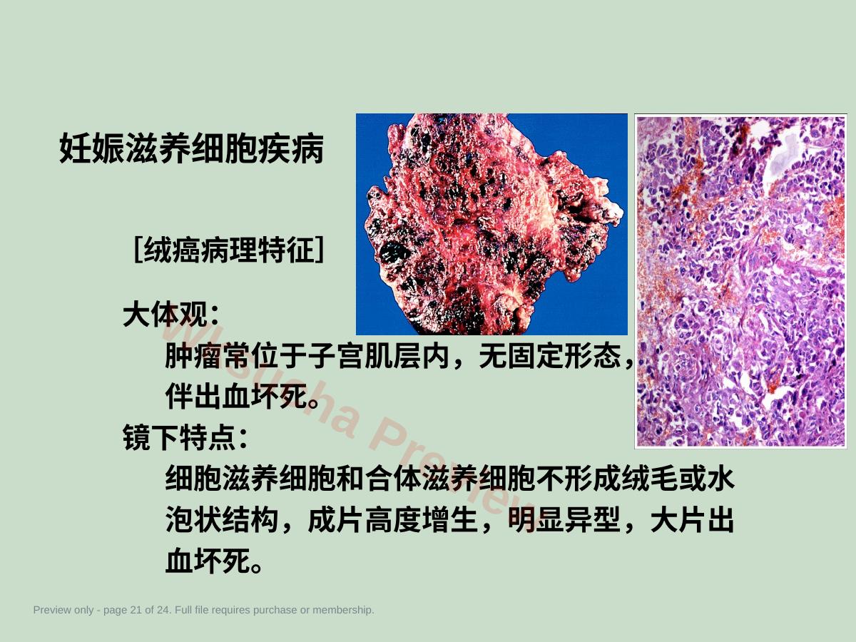 预览第 21 页