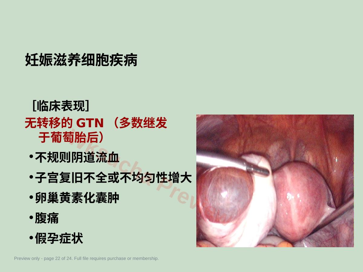 预览第 22 页