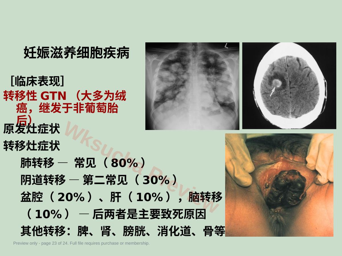 预览第 23 页