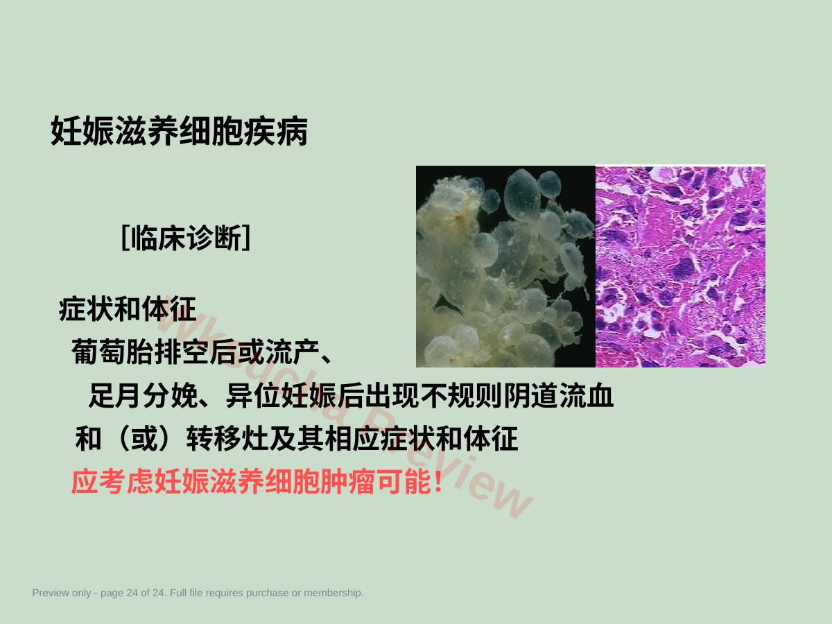 预览第 24 页