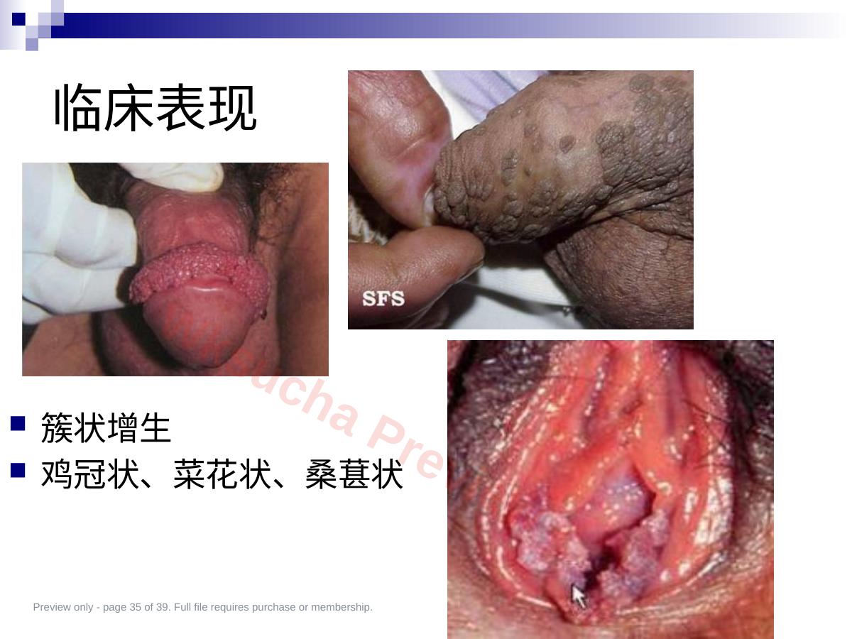 预览第 35 页