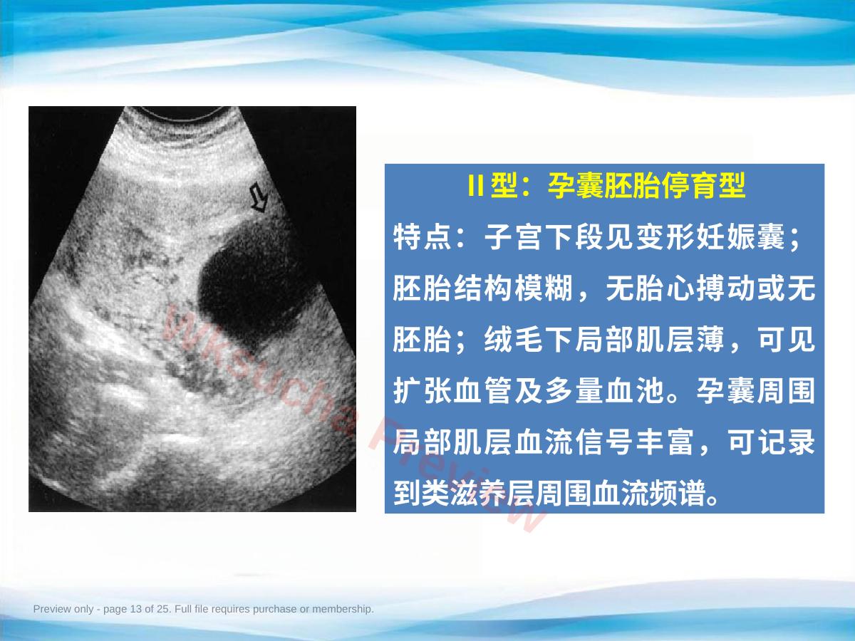 预览第 13 页