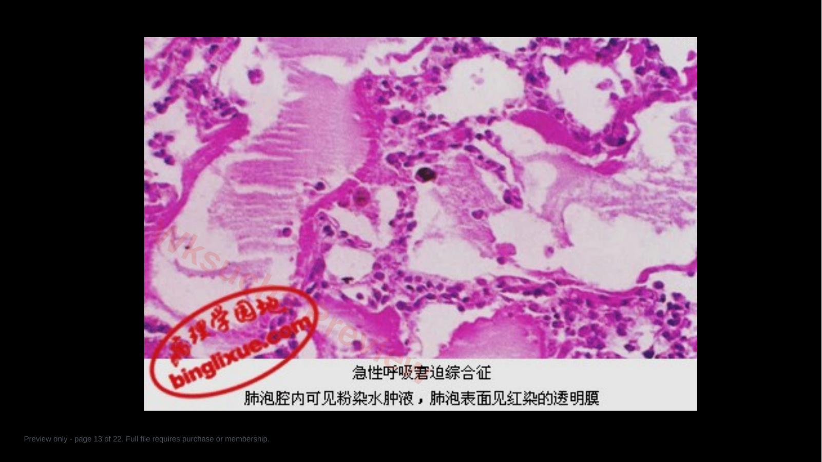 预览第 13 页