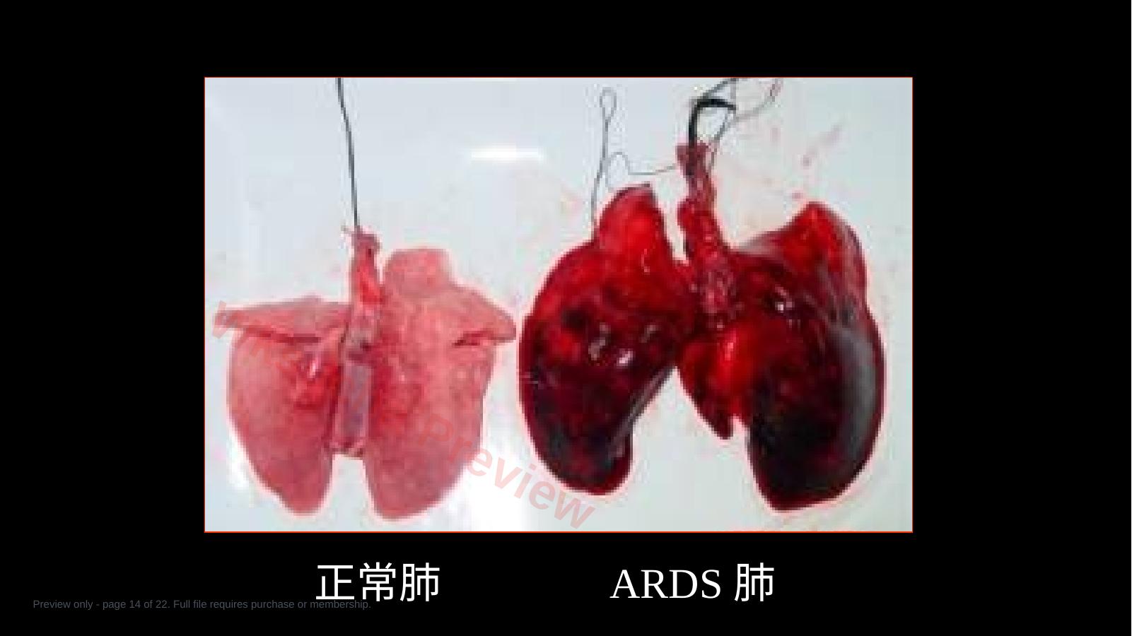 预览第 14 页