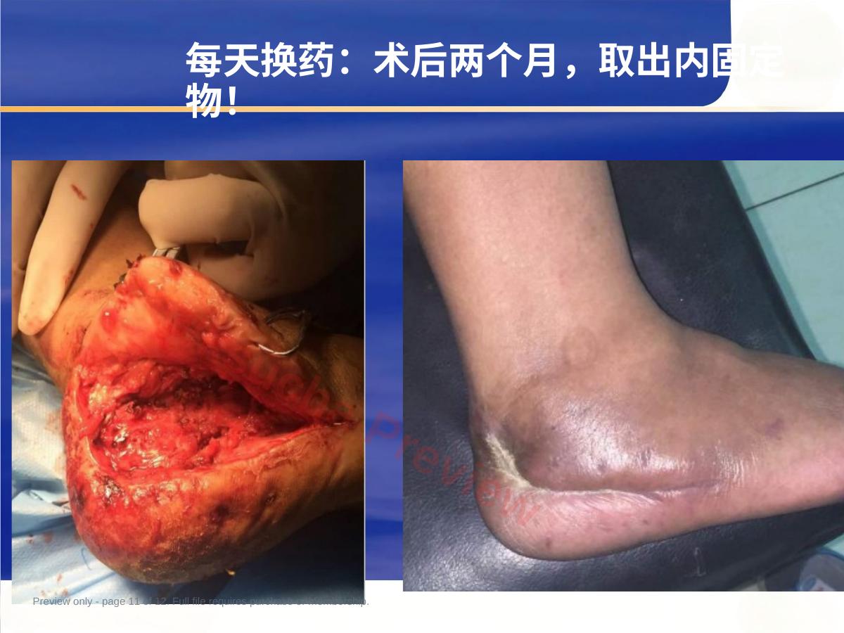 预览第 11 页